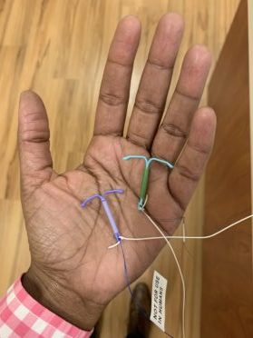 IUD insertion, what to expect.