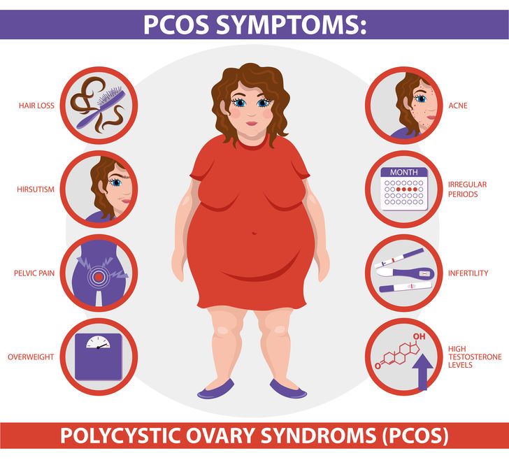 dr-angela-polycystic-ovary-syndrome-symptoms