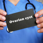 Ovarian Cysts: Types, Symptoms, Diagnosis and Treatment