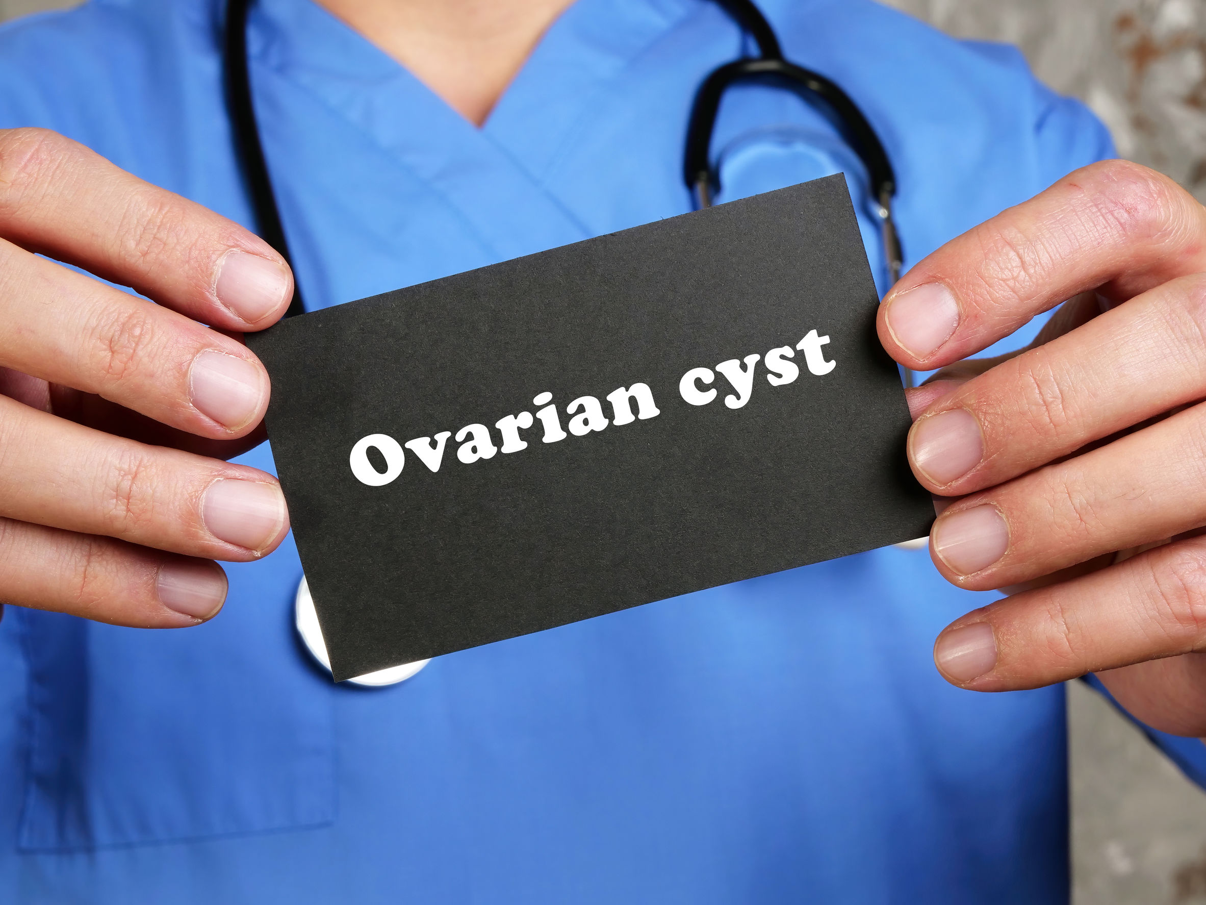 dr-angela-ovarian-cysts